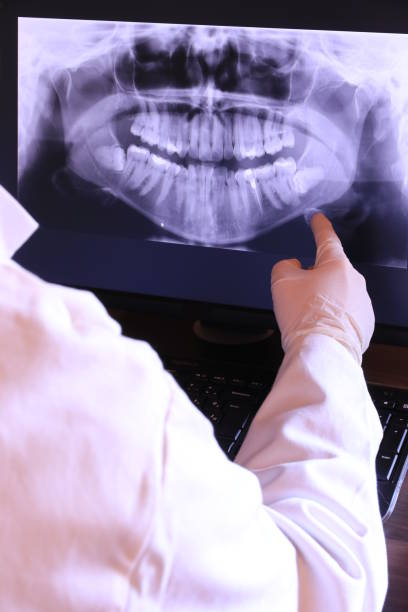 Best Emergency Root Canal Treatment in East Gaffney, SC