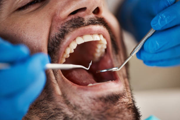 Best Emergency Dental Care for Broken or Chipped Teeth in East Gaffney, SC