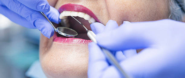 Best Emergency Treatment for Dental Infections or Abscesses in East Gaffney, SC